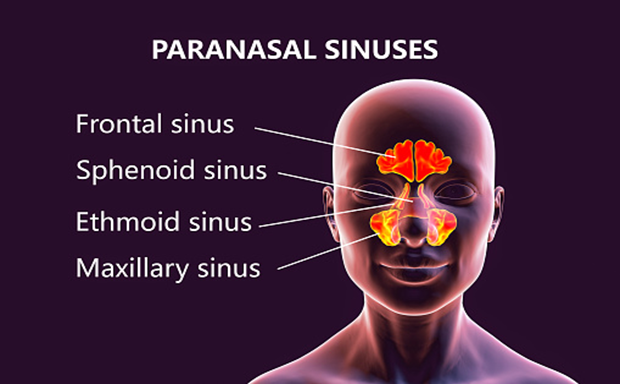 What Are Sinuses and sinusitis 