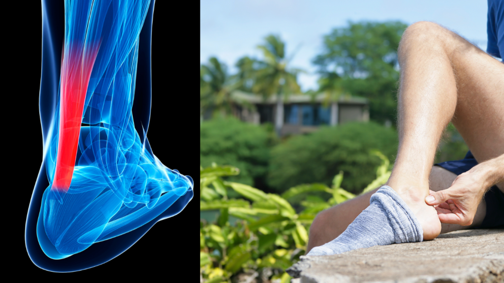 Achilles Tendonitis Symptoms Causes Treatment Preventions
