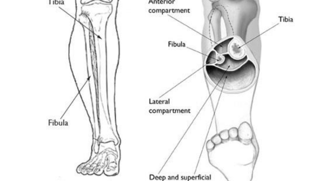Compartment syndrome symptoms Causes Treatment Preventions 